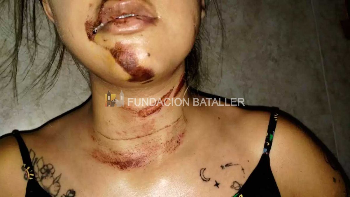 Capital: iba a la facultad y se salvó de milagro tras chocar en moto con un cable y una rama
